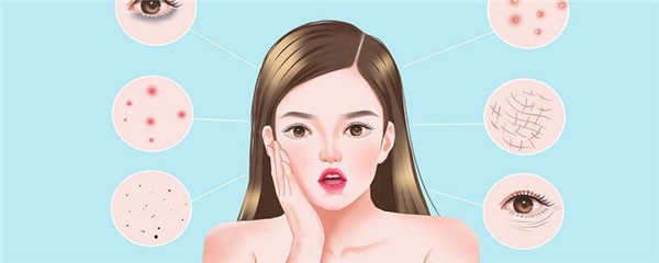 额头上长痘痘抹碘伏管用吗，额头长痘能擦酒精吗 护肤 第1张