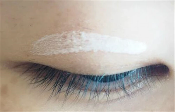 内双怎么变外双 护肤 第3张