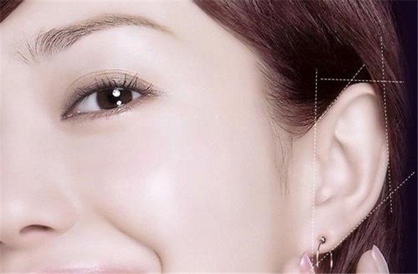 耳部整形手术有哪些注意事项，菜花耳宜做手术矫正 耳部 整形 第1张