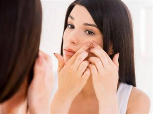 长痘痘的主要原因，这五大因素都会让你青春痘缠身！ 护肤 第2张