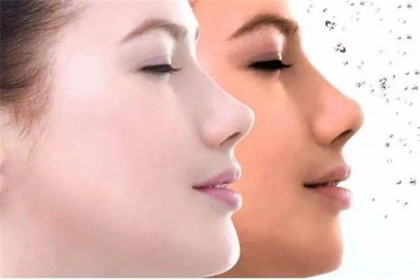 皮肤去角质的正确方法：清除脏东西后要收缩毛孔 皮肤 去角质 第3张