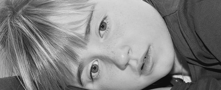 怎样可以淡化雀斑 雀斑 美妆 第3张