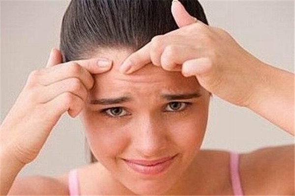 额头长痘的原因：饮食不健康加重废物积累 额头 长痘 第1张