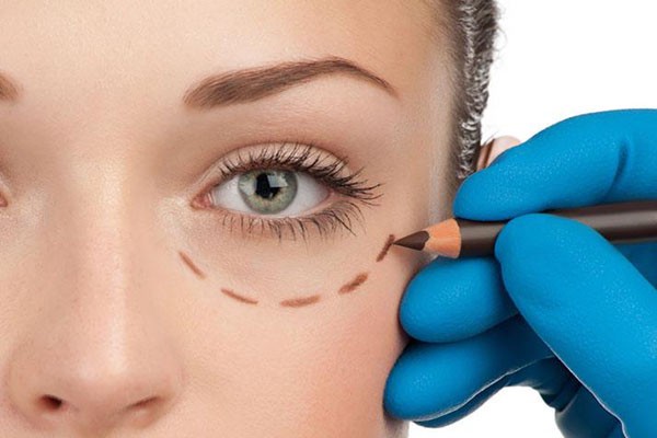 眼袋的形成原因有哪些，眼袋应该注意什么 眼袋 第1张