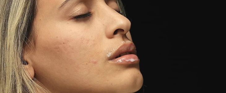 脸上长痘痘了怎么办 痘痘 美妆 第2张