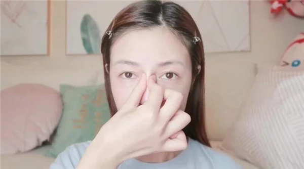 有严重泪沟的人如何改善，泪沟的形成原因都有哪些 泪沟 原因 第5张