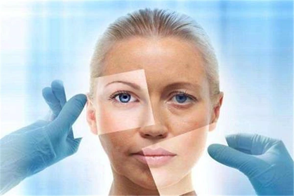 用维e擦脸可减少黑色素的沉淀，滋润补水让皮肤光嫩柔滑 维e 擦脸 第3张