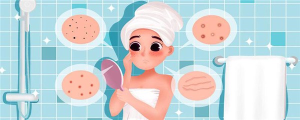 额头上长痘痘是什么原因，额头上长痘痘可以挤掉吗 护肤 第1张