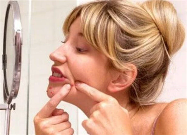 长痘痘的主要原因，这五大因素都会让你青春痘缠身！ 护肤 第3张