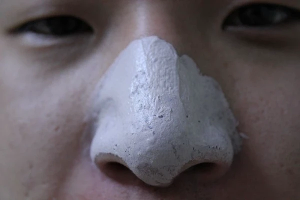 T区的黑头怎么处理,T区黑头有哪些方法可以去除 黑头 第2张 T区的黑头怎么处理,T区黑头有哪些方法可以去除 黑头 第2张