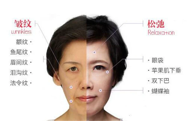 超声刀美容能维持几年，超声刀美容能维持多久 护肤 第3张