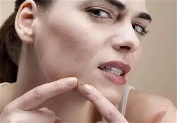 粉刺是怎么形成的,这些都会让你长粉刺 护肤 第1张 粉刺是怎么形成的,这些都会让你长粉刺 护肤 第1张