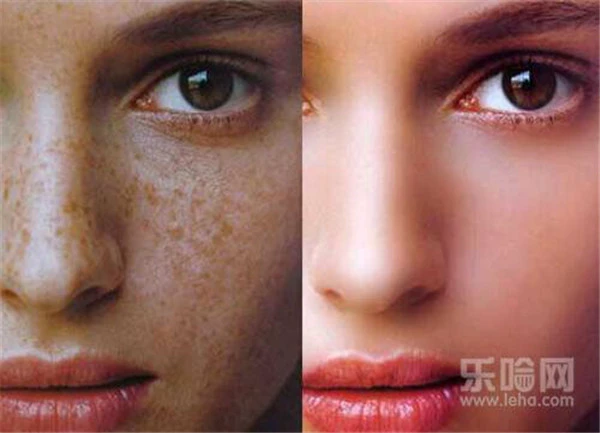 光子祛斑后如何保养 护肤 第3张