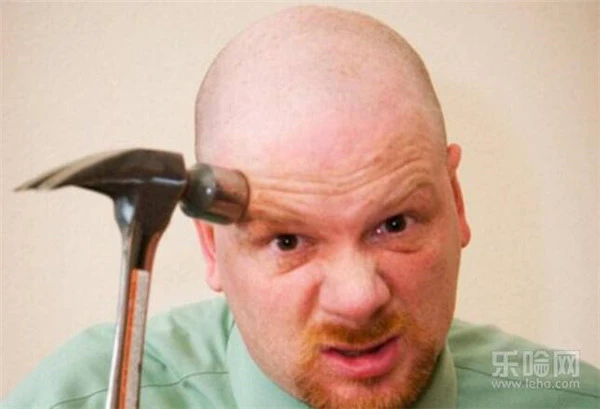 秃头是什么原因造成的 护肤 第2张