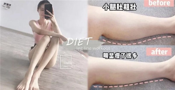 轻松改变小腿外翻瘦出筷子腿！如何判断小腿肌类型 筷子腿 小腿外翻 第1张