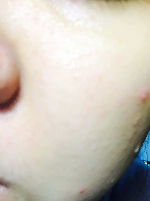 依泉平衡油脂调理面膜怎么样，依泉平衡油脂调理面膜使用测评 面膜 依泉 第4张