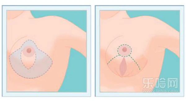 乳晕缩小多久能恢复 护肤 第2张 乳晕缩小多久能恢复 护肤 第2张