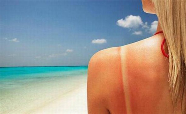 晒伤了用芦荟胶有用吗,晒伤敷芦荟胶、小黄瓜,使用不当可能适得其反! 护肤 第1张 晒伤了用芦荟胶有用吗,晒伤敷芦荟胶、小黄瓜,使用不当可能适得其反! 护肤 第1张