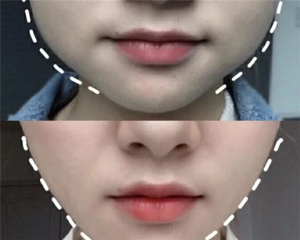 超简单瘦脸操搭配瘦身减脂效果会更好，水肿脸少吃重口味食物 瘦脸操 减脂 第2张