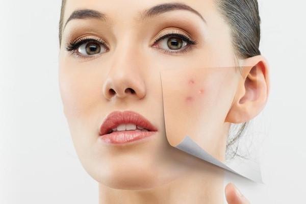 痘痘为什么是硬的，痘痘里面是什么 痘痘 第2张