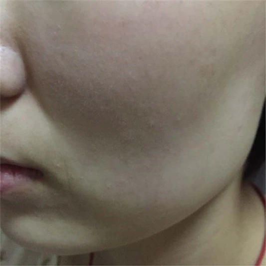 欧珀莱蕴泽水活睡眠面膜怎么样,效果好吗 面膜 欧珀莱 第4张 欧珀莱蕴泽水活睡眠面膜怎么样,效果好吗 面膜 欧珀莱 第4张