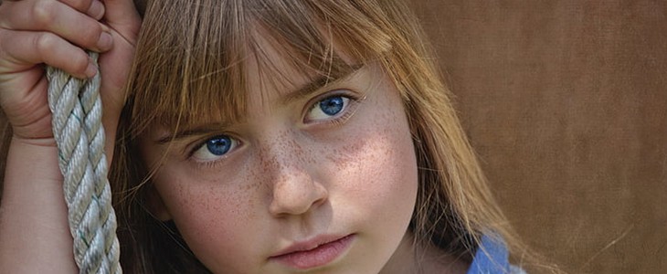 黄褐斑怎么回事 黄褐斑 美妆 第3张