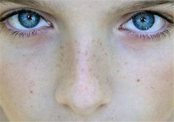 如何清除黑头和粉刺,清除黑头粉刺缩毛孔有妙招 护肤 第2张 如何清除黑头和粉刺,清除黑头粉刺缩毛孔有妙招 护肤 第2张