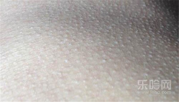 磨砂膏能去鸡皮肤吗 护肤 第1张