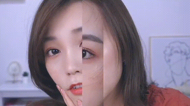 如何选择合适的双眼皮类型，双眼皮的种类 双眼皮 第10张