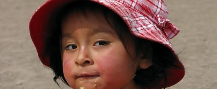 怎么去红血丝 红血丝 美妆 第1张 怎么去红血丝 红血丝 美妆 第1张