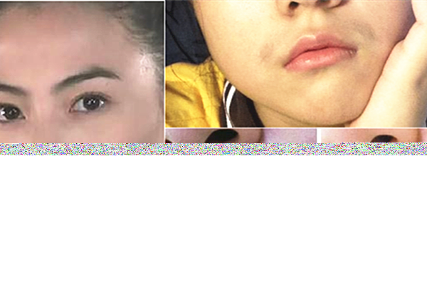 有小胡子怎么办，漂胡剂是否是能真的致癌呢 小胡子 第1张