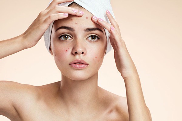 都长痘痘了这些东西就不要再吃了 食物 第1张 都长痘痘了这些东西就不要再吃了 食物 第1张