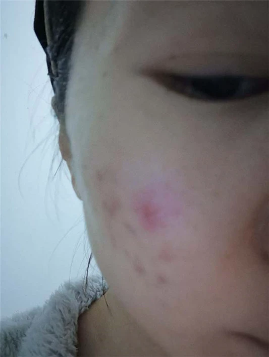 悦木之源菌菇水怎么样,悦木之源菌菇水使用测评 悦木之源 菌菇水 第4张 悦木之源菌菇水怎么样,悦木之源菌菇水使用测评 悦木之源 菌菇水 第4张