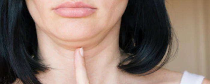 怎么才能减双下巴 减双下巴 美妆 第1张