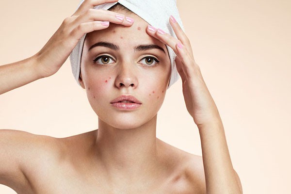 与痘痘为敌的食物，帮你祛痘排毒 排毒 第1张