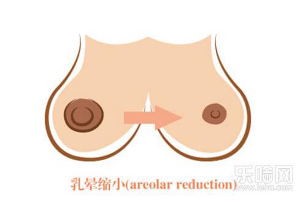 乳晕缩小多久能恢复 护肤 第1张 乳晕缩小多久能恢复 护肤 第1张
