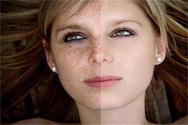 皮肤干燥发痒用维生素E，2个月皮肤就变好 皮肤 第1张