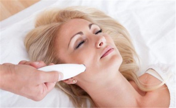 激光祛斑要多长时间，激光去色素斑诊治功夫比较短 激光 祛斑 第1张