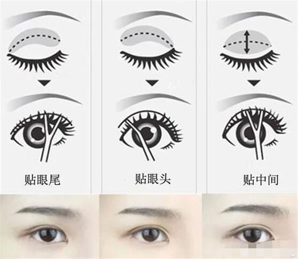 贴双眼皮的技巧有哪些，选择透气性好的双眼皮贴 技巧 贴双眼皮 第2张