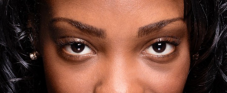 怎么样才能去眼袋 眼袋 美妆 第1张