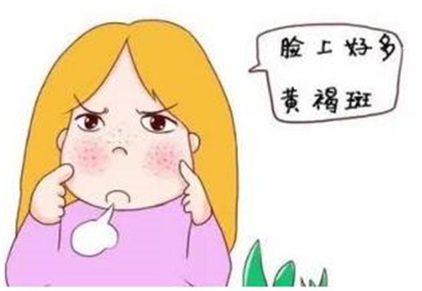 祛黄褐斑的最佳方法是什么 黄褐斑 祛黄褐斑 美妆 第1张