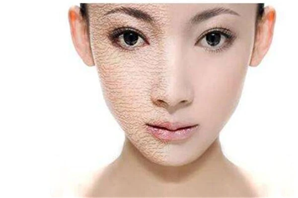 好皮肤要少吃甜食，适当清洁亮白肌肤保持干净 皮肤 清洁 第3张