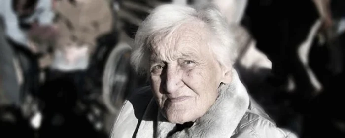 黄褐斑是什么原因引起的 黄褐斑 美妆 第2张