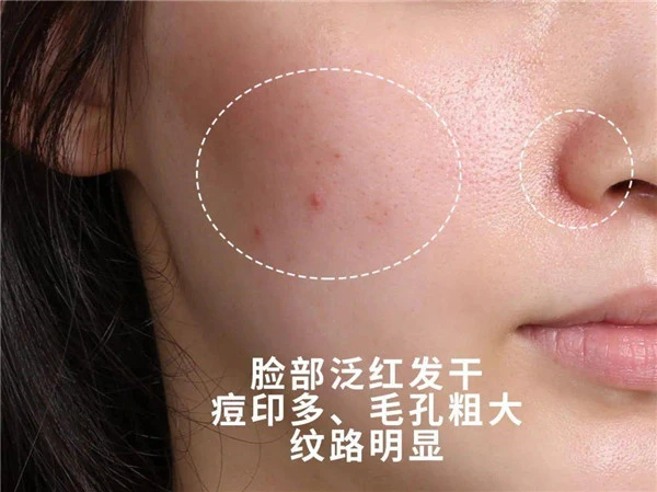 LA，MER酸橙茶精萃强韧肌肤，打造医美效果 酸橙茶精萃 LA MER 第20张