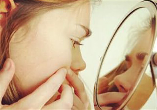 挤痘痘挤出来的是什么 护肤 第1张