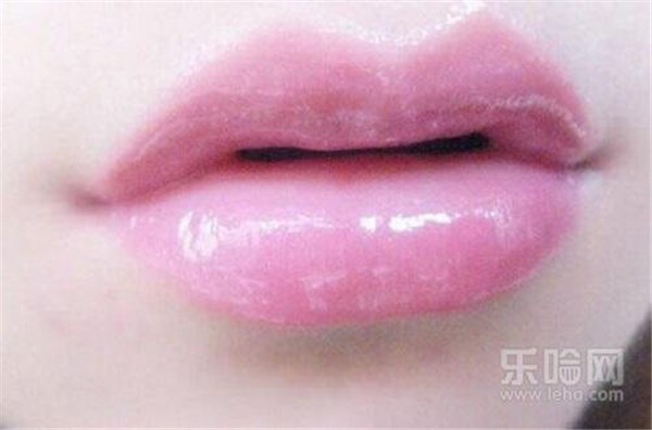 漂唇增生怎么处理 护肤 第1张