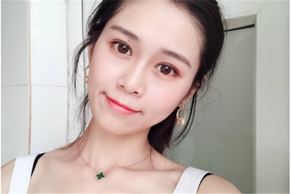 双眼皮手术全切保持的时间久，埋线保守不需开刀 双眼皮 手术 第1张