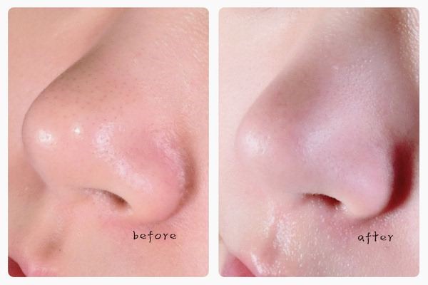 做了个面膜会起泡，是因为面膜过期了吗 面膜 第1张