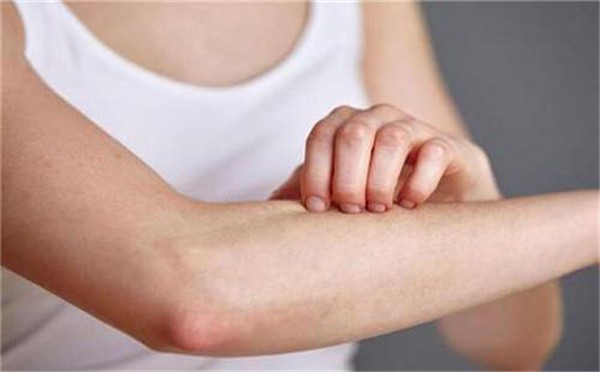 皮肤过敏瘙痒怎么办，五个止痒小妙招教给你 护肤 第1张