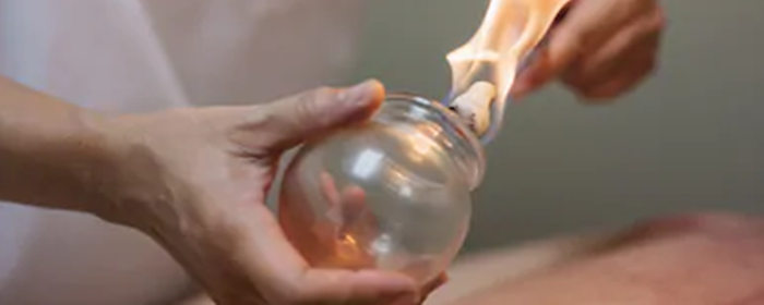 拔罐减肥反弹吗 拔罐减肥 美妆 第1张 拔罐减肥反弹吗 拔罐减肥 美妆 第1张